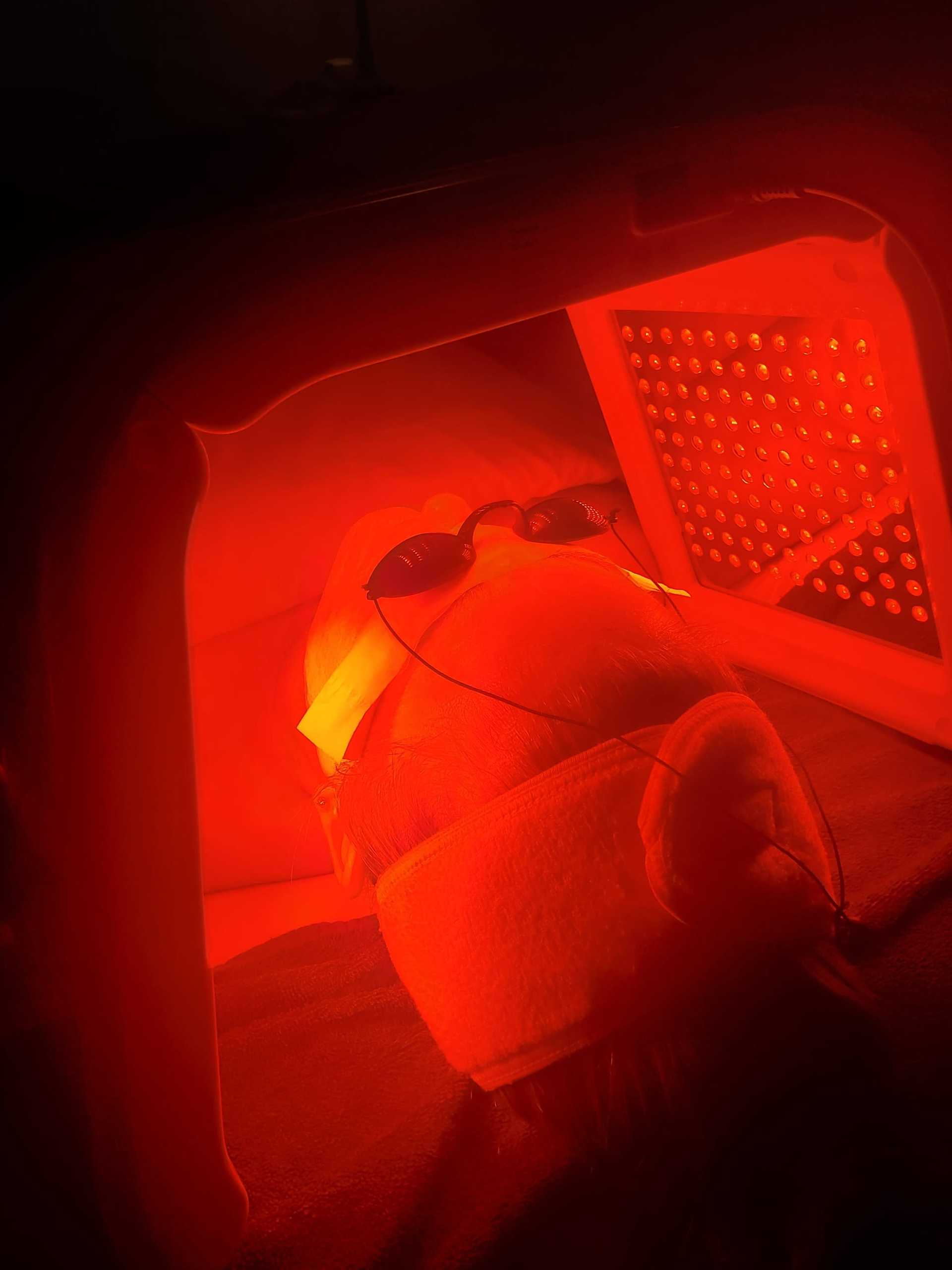 Person undergoing red light therapy, wearing goggles and a headband, lying under LED lights.